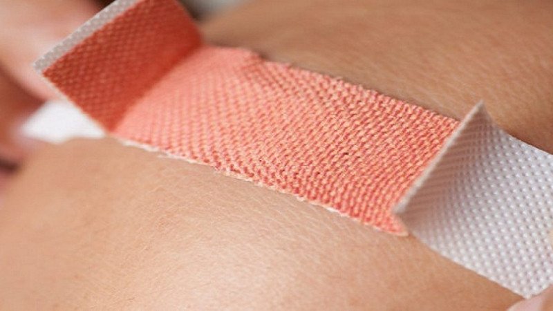 Băng bó vết thương trầy xước sau tai nạn xe