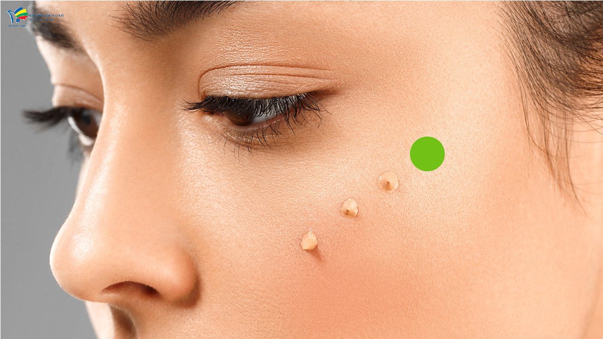 Sử dụng kem lót hiệu chỉnh màu xanh lá để làm dịu các nốt đỏ trên da